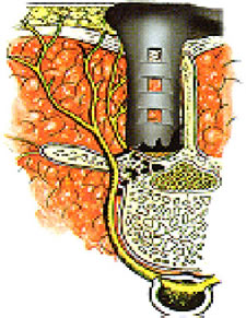 ns---stenosis-2.jpg